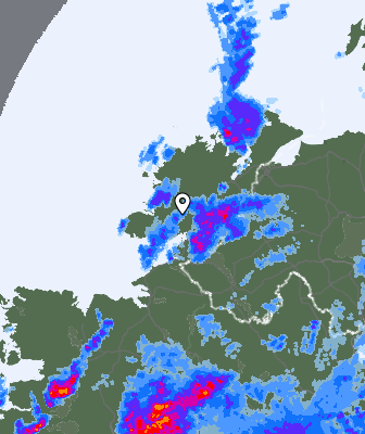 Radar