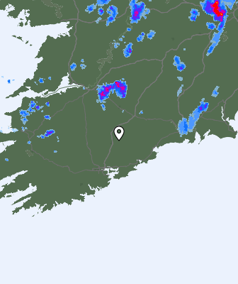 Radar