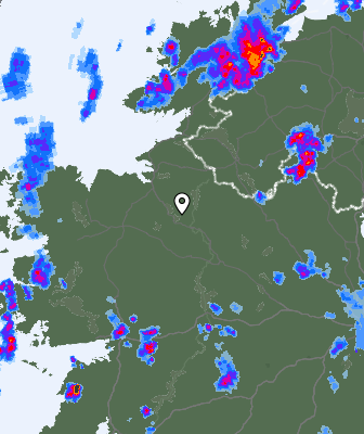 Radar