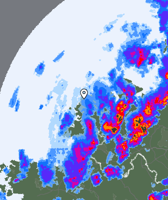 Radar