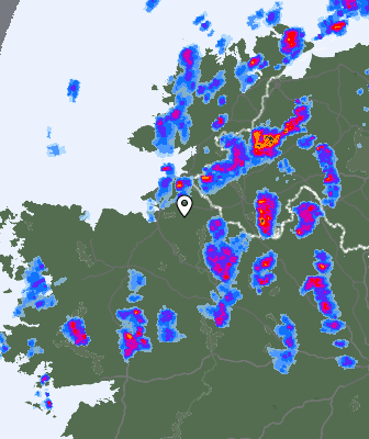 Radar