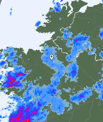 Radar