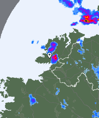 Radar