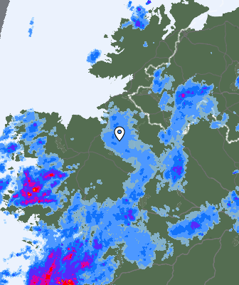 Radar
