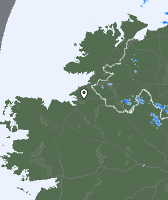 Radar