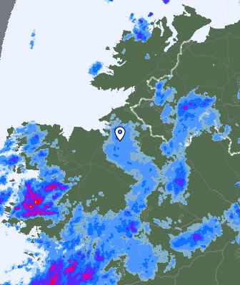 Radar