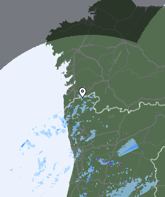 Radar