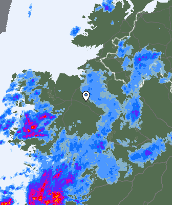Radar