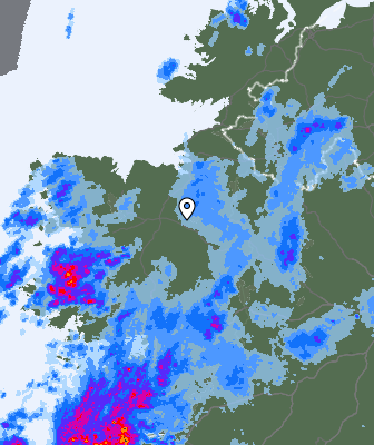 Radar