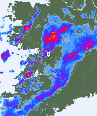 Radar