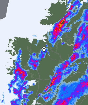 Radar
