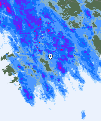 Radar