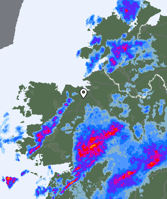 Radar