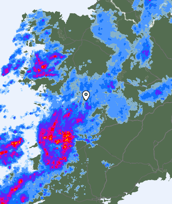 Radar