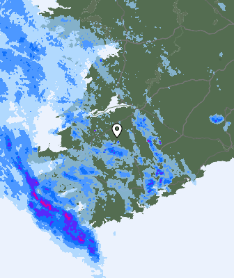 Radar