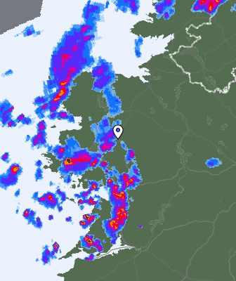 Radar