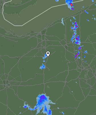 Radar