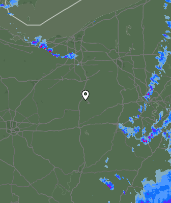 Radar