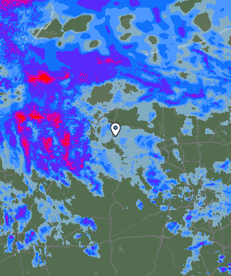 Radar