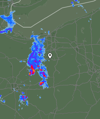 Radar