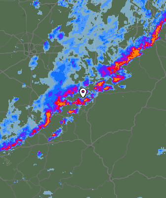 Radar