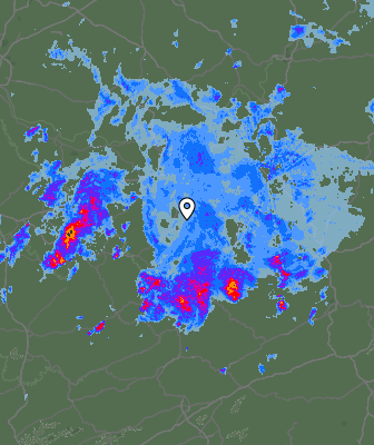 Radar