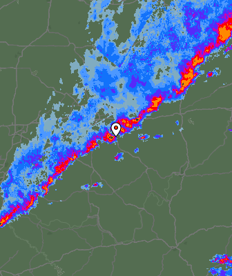 Radar