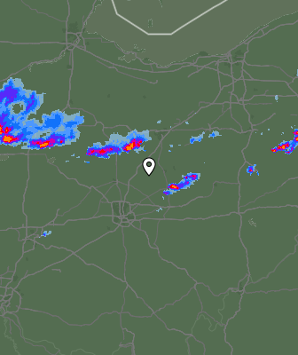 Radar