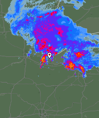 Radar
