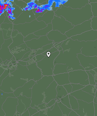 Radar