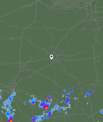 Radar