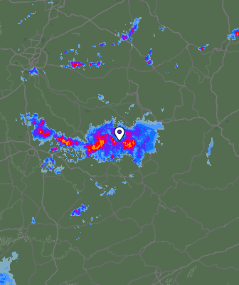 Radar