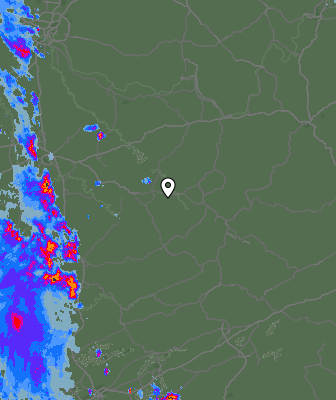 Radar