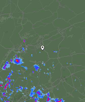 Radar
