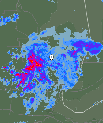 Radar