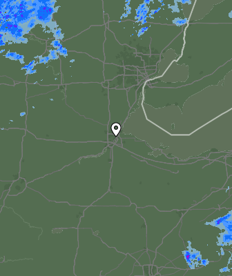 Radar