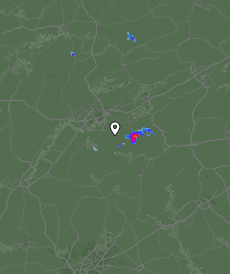 Radar