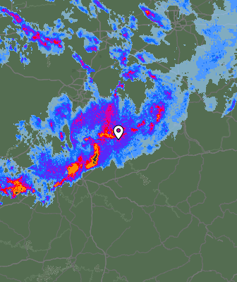 Radar