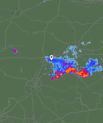 Radar