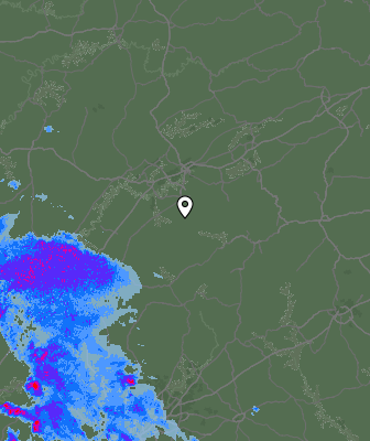Radar