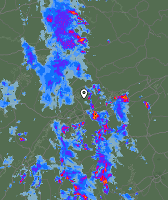 Radar