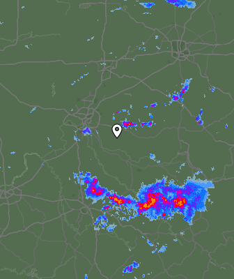 Radar