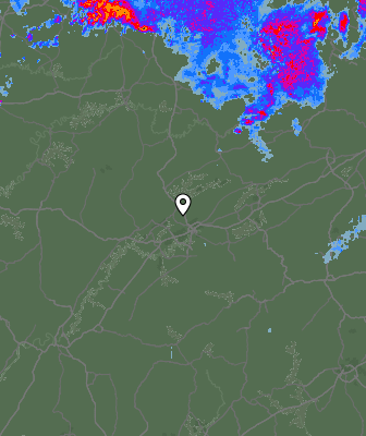 Radar
