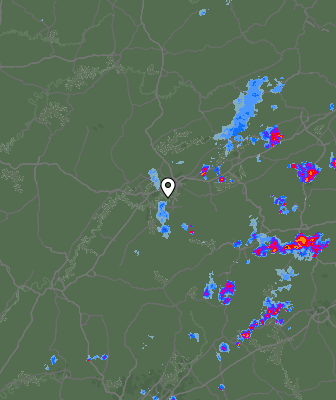 Radar