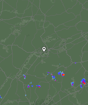 Radar