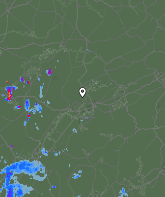 Radar