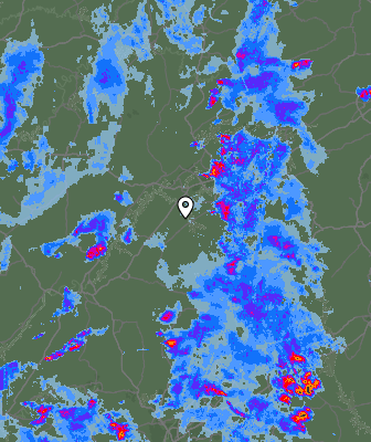 Radar