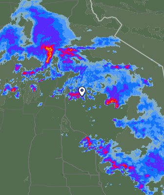 Radar