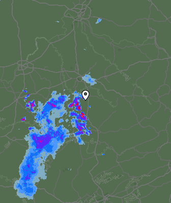 Radar