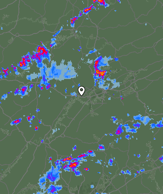 Radar